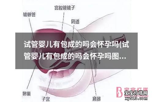 试管婴儿有包成的吗会怀孕吗(试管婴儿有包成的吗会怀孕吗图片)