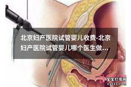 北京妇产医院试管婴儿收费-北京妇产医院试管婴儿哪个医生做的好