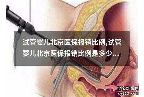 试管婴儿北京医保报销比例,试管婴儿北京医保报销比例是多少：试管婴儿北京医保报销比例分析