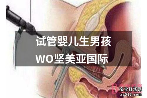 试管婴儿生男孩WO坚美亚国际