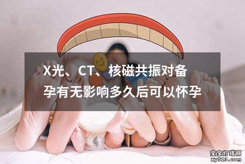 X光、CT、核磁共振对备孕有无影响多久后可以怀孕